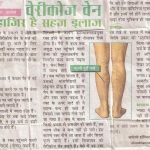 Press Coverage 150