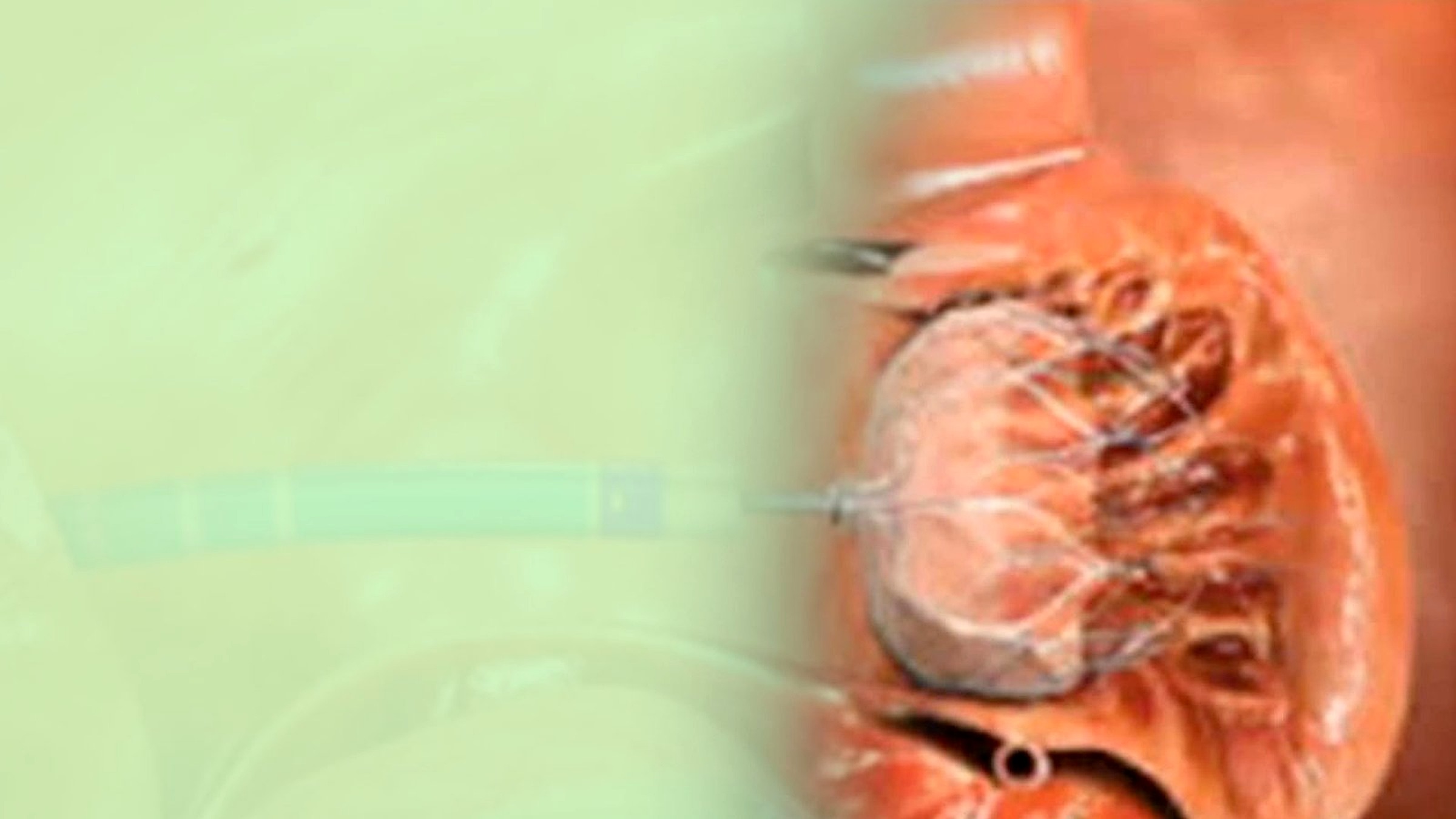 Cardiac structural care visual