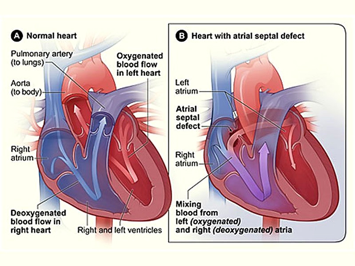 Structural heart disease procedure visual