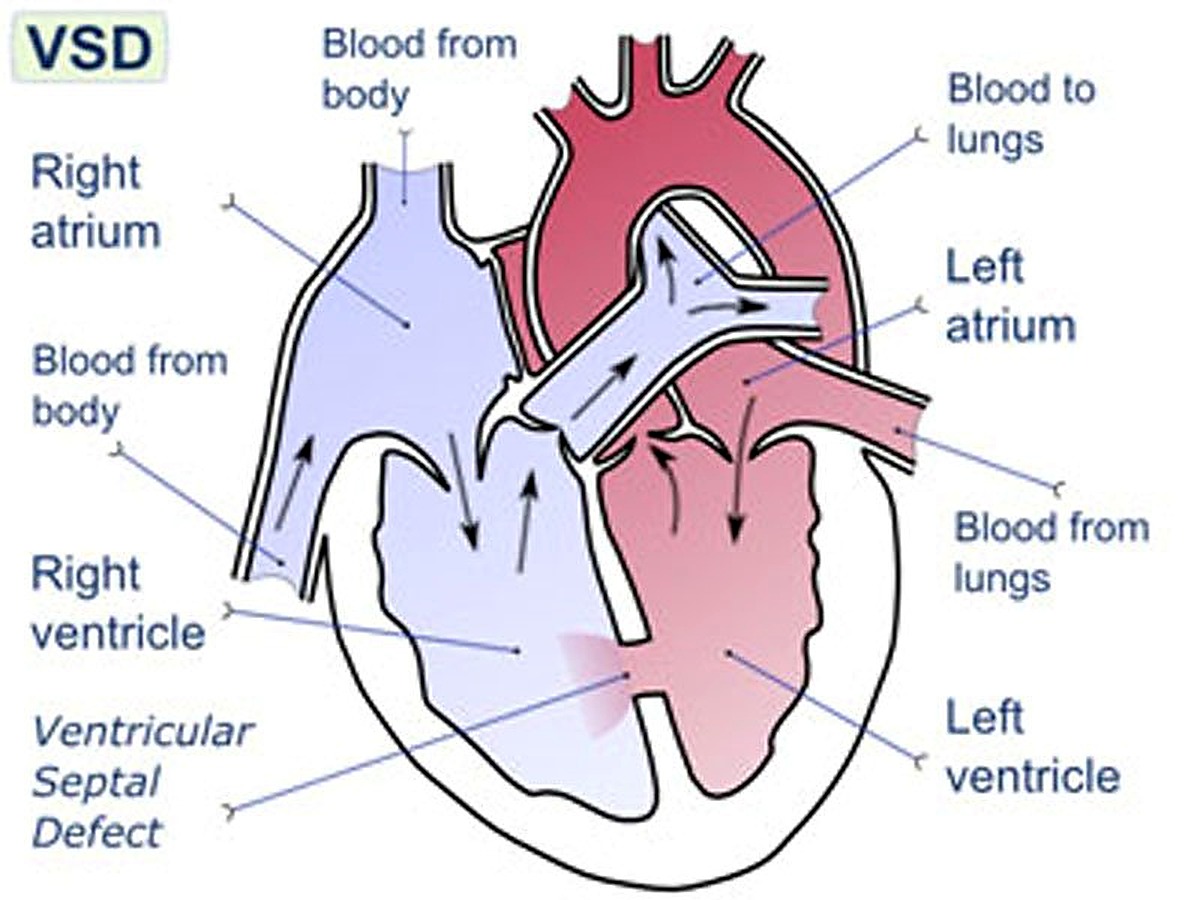 Structural heart treatment visual