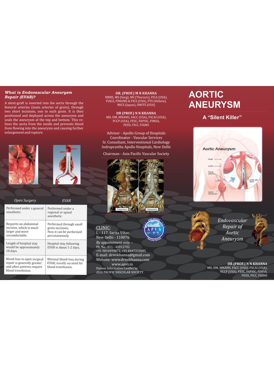 Aortic Aneurysm